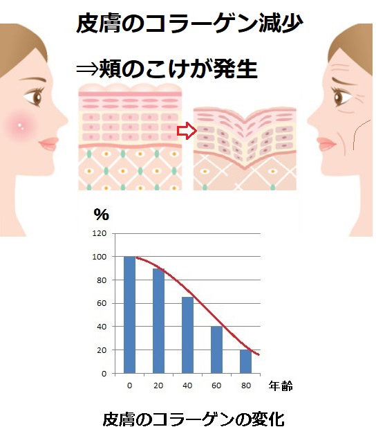 頬のこけの原因と改善方法 自宅ケア方法 形成外科専門医が解説