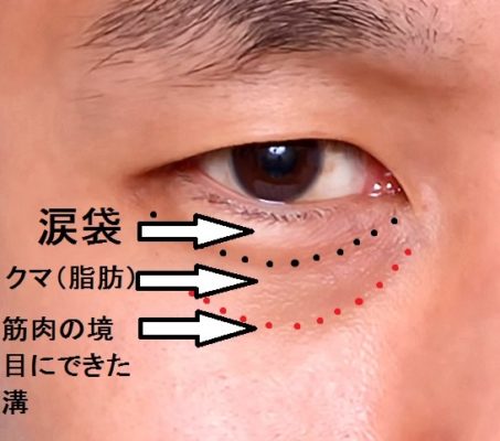 【まとめ】 涙 袋 気持ち 悪い 歴代彼氏・彼女まとめ #687