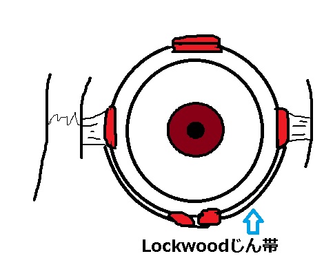 Loockwoodじん帯が眼球を支えており、ゆるむことで目の下の脂肪（眼窩脂肪）が出てくる