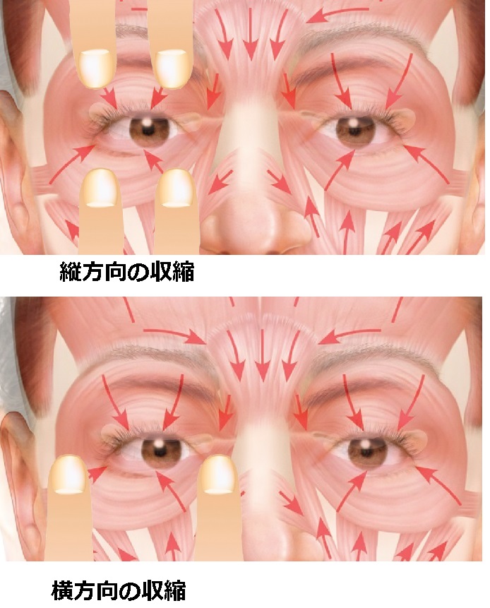 笑った時だけ涙袋が出る症状について 原因と解消法